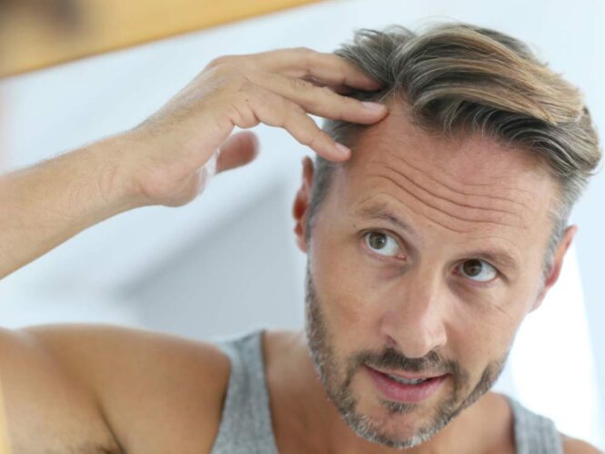 How Does The Use of Medicated Shampoo Formulas Address The Onset of Hair Loss For Men?