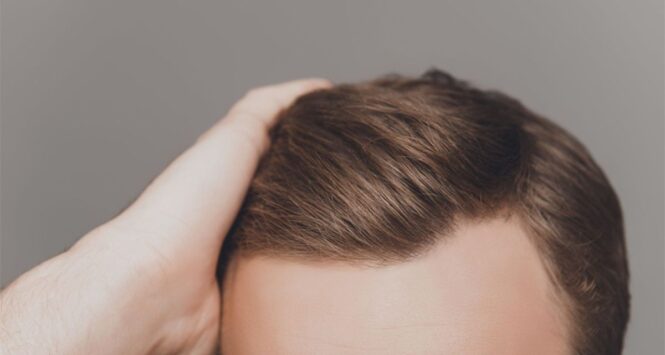 Hair Transplant Surgery - Causes, Treatments and Risks