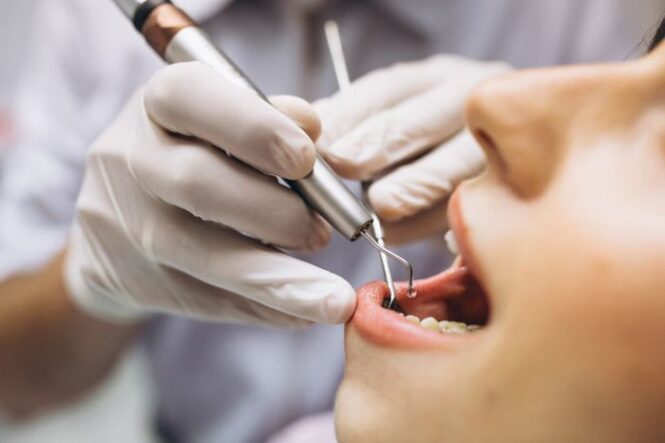 6 Different Types Of Dental Implant Procedures in 2023