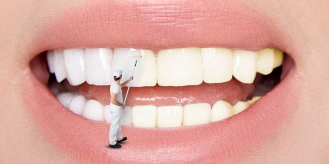 Stains on Your Teeth: Types, Causes And Removing Options