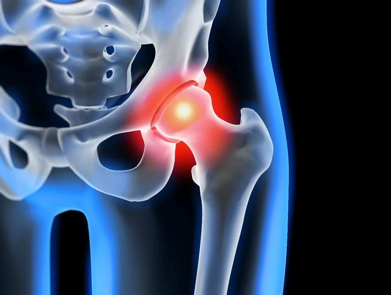5 Best Chairs for Hip Osteoarthritis in 2023