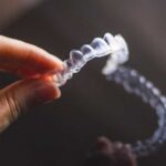 Frequently Asked Questions and Common Concerns on Invisalign